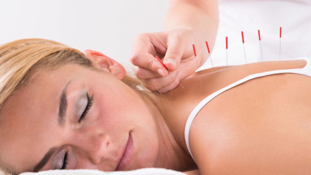 Hand Performing Acupuncture Therapy
